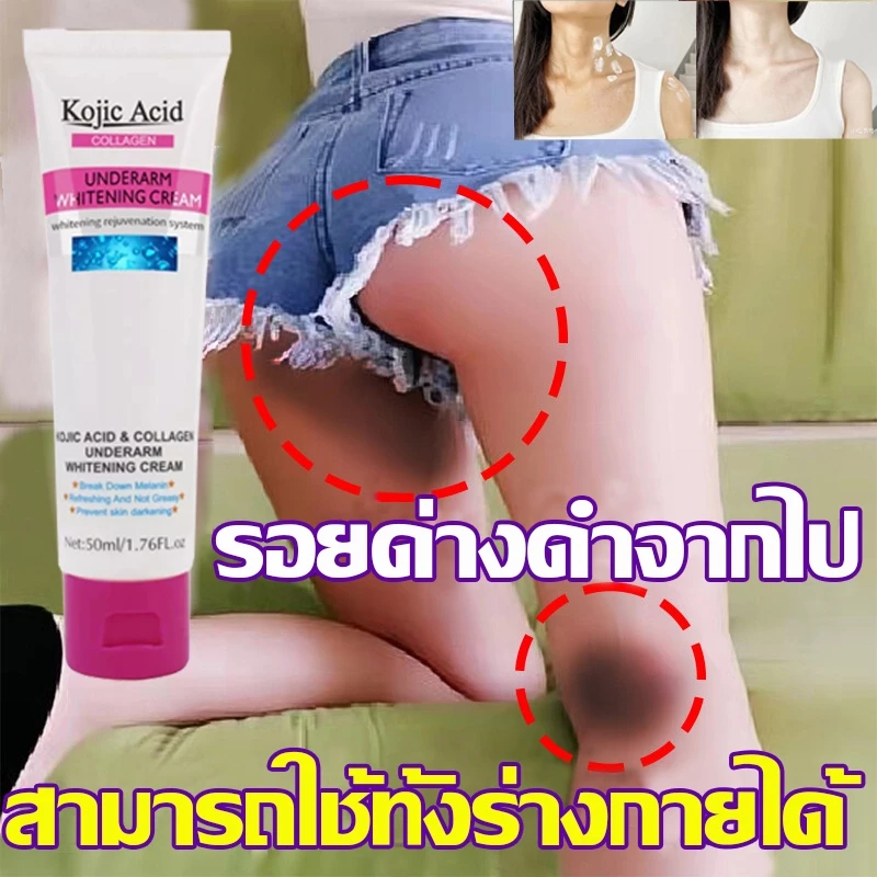 Kojic Acid ครีมขาหนีบดำ 50ml ครีมทารักแร้ขาว ครีมบำรุงรักแร้ เข่าดำ ผิวขาว สิ่งประดิษฐ์ ครีมขาหนีบดำ