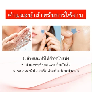 【ซื้อ 4 แถม 1】แปะสิว แปะตราสิว ดูดหนอง สามารถแต่งหน้า หยอกล้อคอนซีลเลอร์ปัดสิวได้ แผ่นแปะสิวดูดหนอง