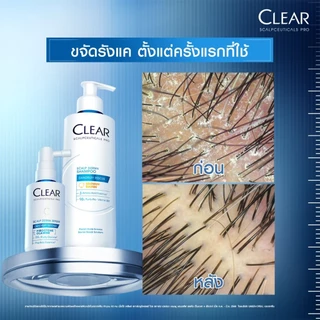 [เคลียร์พรีเมี่ยม][เซ็ท2ขั้นตอน] เคลียร์ สกาล์ปซูติคอลส์ โปร แชมพูสูตรอ่อนโยน 300มล.+ แชมพูขจัดรังแค 200มล. x1