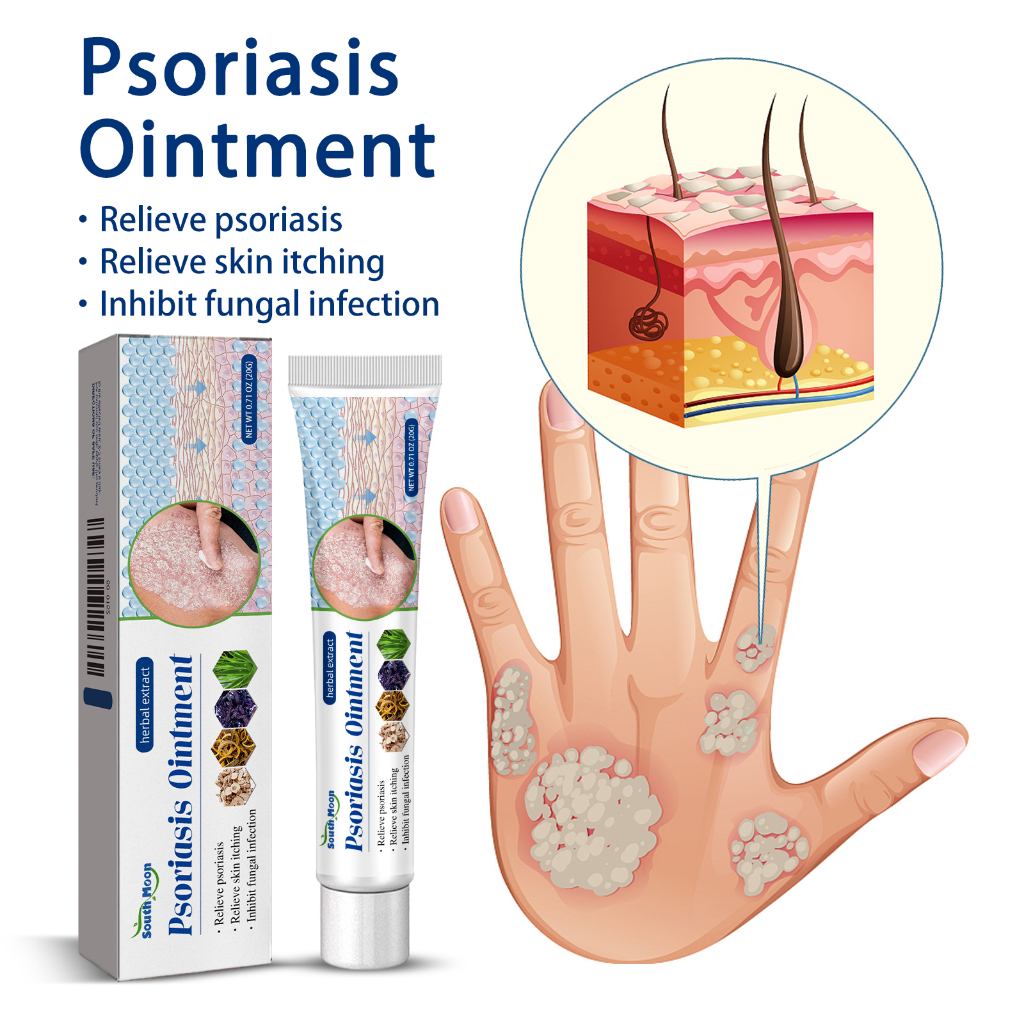 South Moon Psoriasis Ointment 20g บรรเทาอาการคันจากโรคสะเก็ดเงิน ยับยั้งการติดเชื้อรา ครีมบำรุงผิว