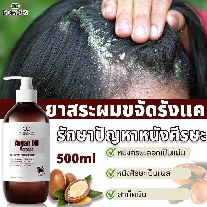 แชมพูขจัดรังแค แชมพูรังแค ยาสระผมขจัดรังแค ขจัดปัญหารังแคและลดความคันบนหนังศีรษะ ยาสระผมรังแค กำจัด เชื้อราบนหนังศรีษะ
