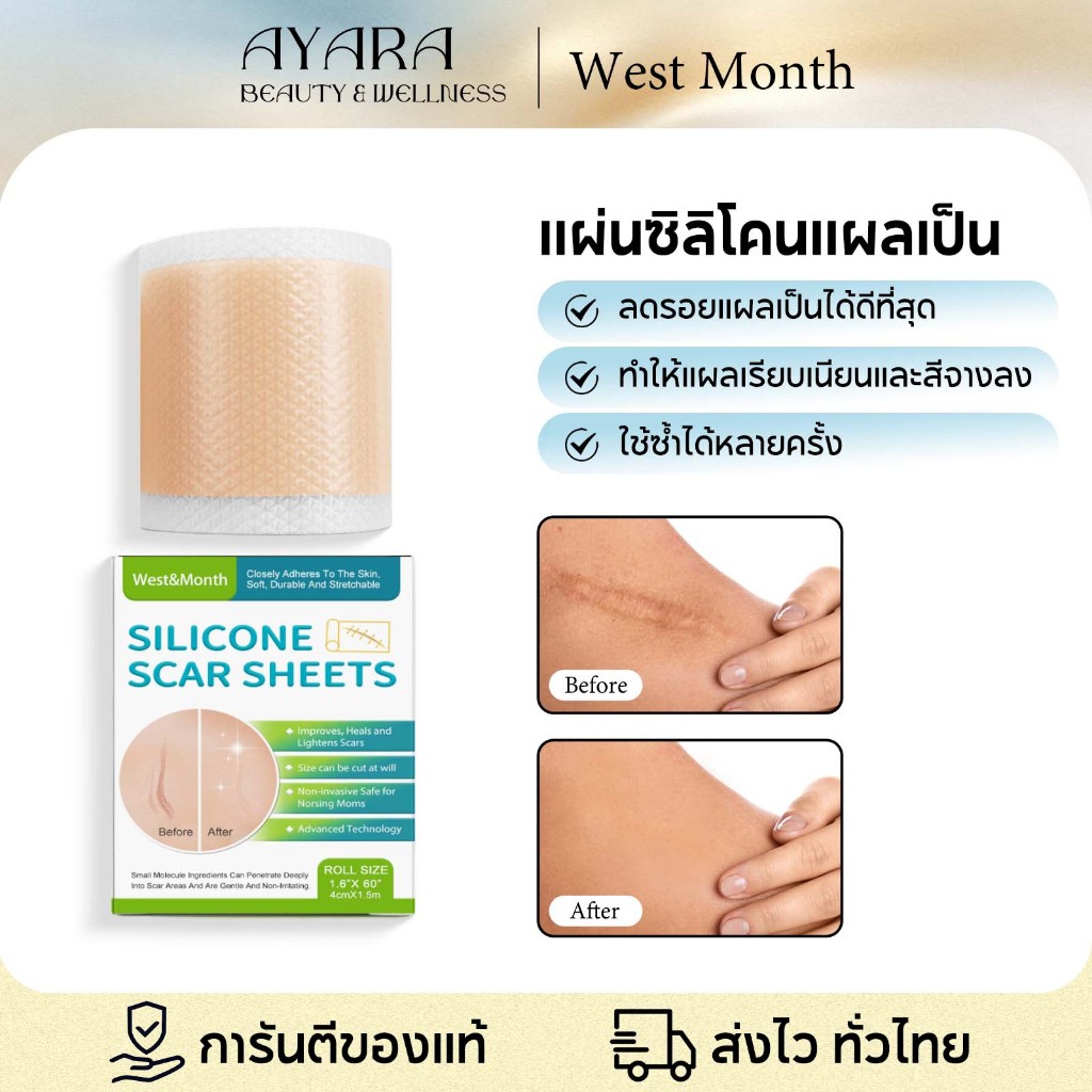 West&Month แผ่นแผลเป็นซิลิโคน (4 ซม. x 150 ซม.) แผ่นแปะแผลเป็น silicone scar sheet รักษารอยแผลเป็น ลดแผลเป็น แก้แผลเป็น