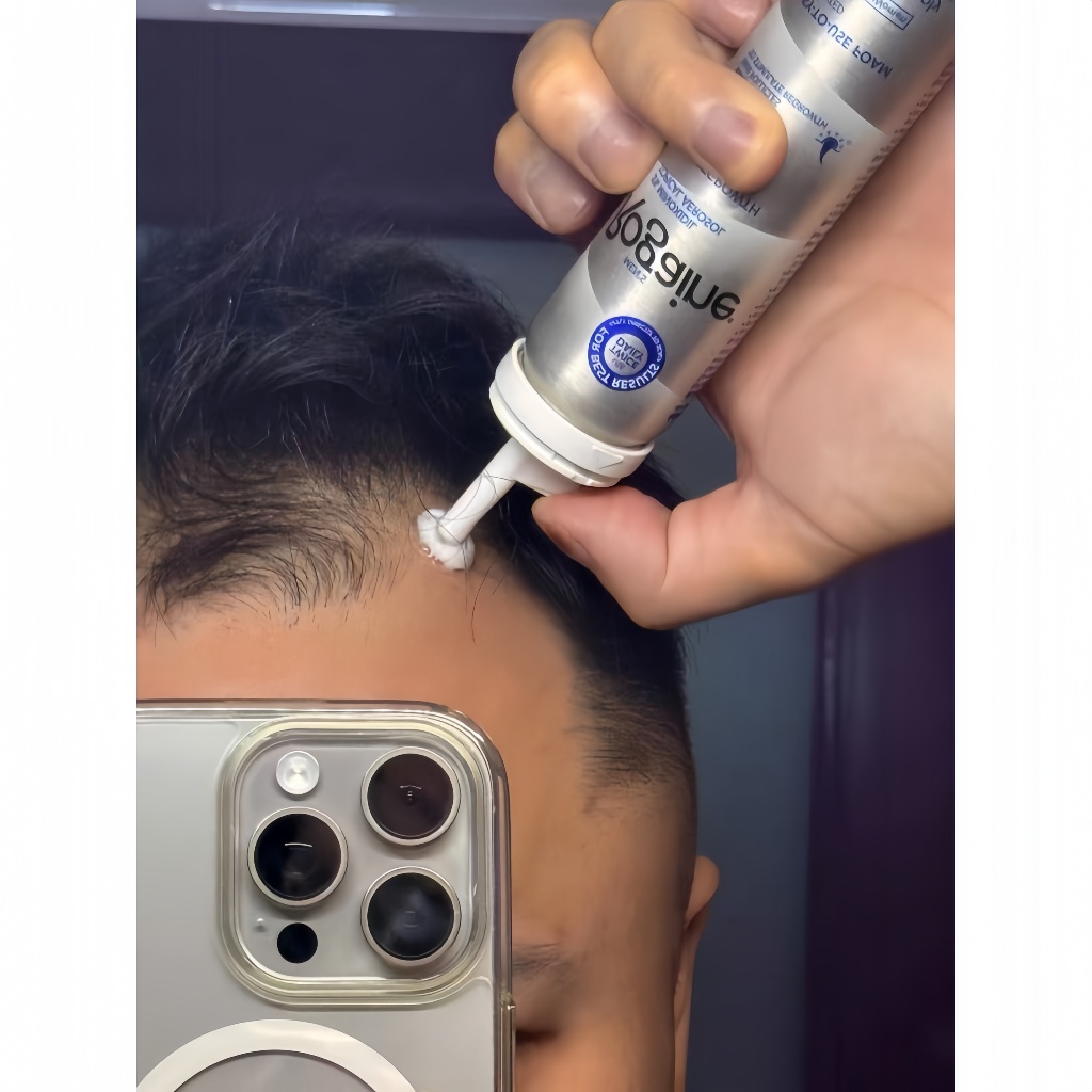 〖 〖ของแท้100%〗Rogae โฟมปลูกผมสหรัฐฯ ฟื้นฟูรากผม เร่งผมงอกไว ดูแลหนังศีรษะ ลดผมร่วง ผมบางหยุดร่วง ปลูกผมเห็นผลชัดเจน 〗