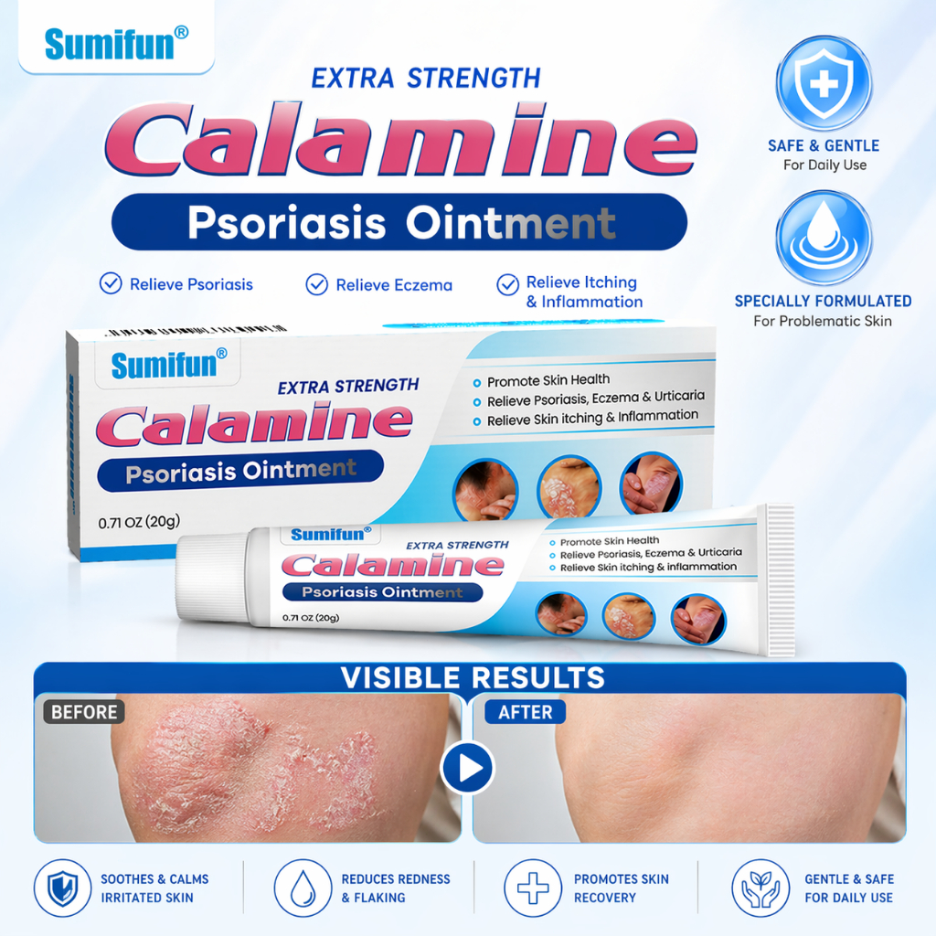 Calamine Psoriasis Ointment ครีมรักษาสะเก็ดเงิน บรรเทาอาการคัน ลดผื่นแดง ซ่อมแซมผิว สูตรอ่อนโยน