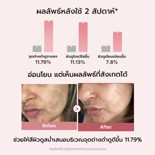 MEDICUBE PDRN Pink Peptide Serum เมดิคิวบ์ พีดีอาร์เอ็น พิงค์ เพปไทด์ เซรั่ม