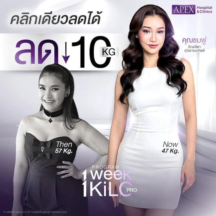 [E-Voucher] APEX โปรแกรม 1Week 1 Kilo(ปักปากกา มอนจาโร )ลงลิฟต์ไว ไม่หิวบ่อย 20โดส ฟรี2 โดยแพทย์APEX
