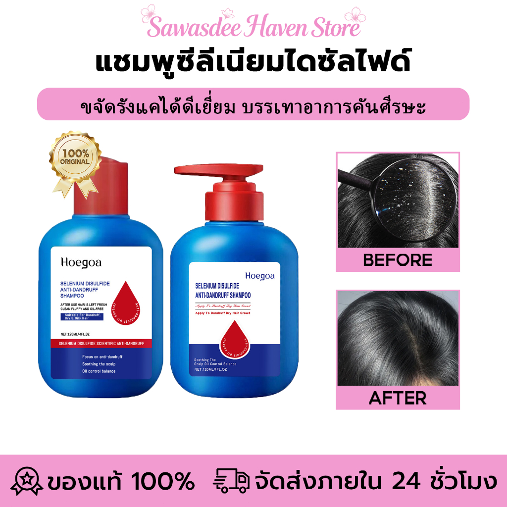 Hoegoa แชมพูซีลีเนียมไดซัลไฟด์ ป้องกันรังแคและควบคุมความมัน บรรเทาอาการคันศีรษะ
