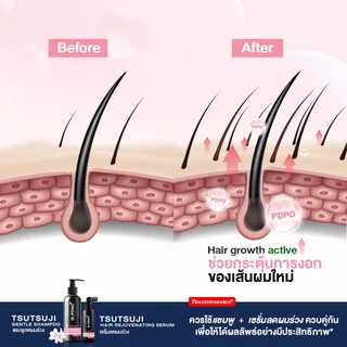 [ขายดี] เซรั่มลดผมร่วง Dr.PONG TSUTSUJI HAIR REJUVENATING SERUM - anti-hairloss serum เซรั่มบำรุงผม ลดผมร่วง