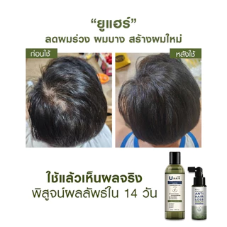 U hair anti hair loss serum (50ml.) 1 ขวด
