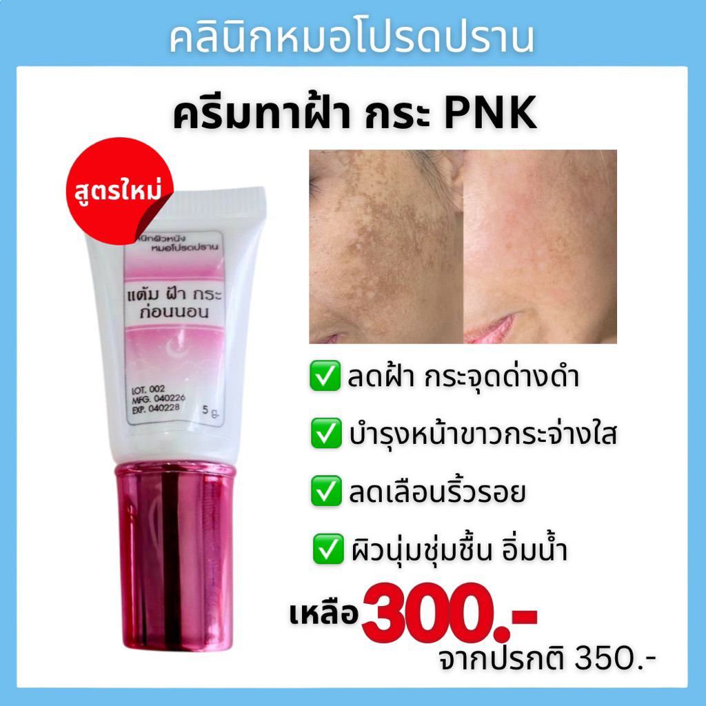ครีมแต้มฝ้า PNK สูตรใหม่ คลินิกหมอโปรดปราน