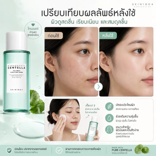 SKIN1004 โทนเนอร์ 210ml. มีหลายสูตรให้เลือก เนื้อบางเบาซึมไว สูตรอ่อนโยน ลดแดง ปลอบประโลมผิวแพ้ง่าย เหมาะกับทุกสภาพผิว
