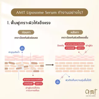[มีของแถม] (แพ็คคู่) AMT Liposome Serum 50 mL แถมฟรี!! แถมฟรี! เซรั่ม 30mL