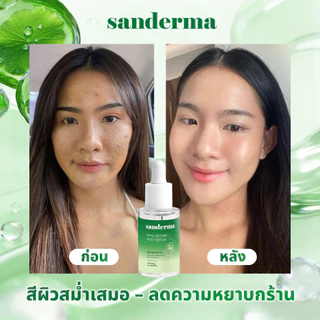 NEW SANDERMA เซรั่ม HA+ครีมบำรุงผิว ต้านอักเสบ ลดผื่นคัน กลาก ผิวแห้งแตก เสริมเกราะผิว ครบสูตร 30ml+50g
