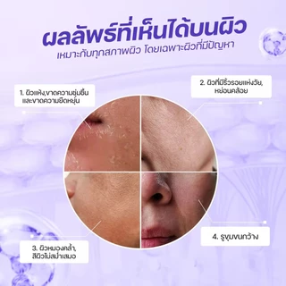 แถมฟรี! มาส์กหน้า B5 ฟื้นบำรุงและเพิ่มความชุ่มชื้นแบบครบสูตร