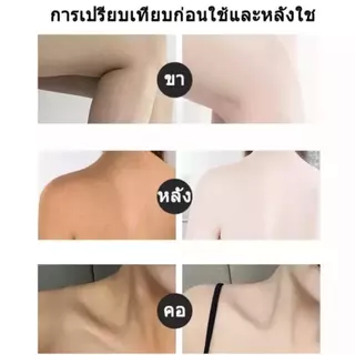 โลชั่นไวท์เทนนิ่งผิวกาย 100g ปรับผิวขาวทั้งตัว ผิวสวยใสเร็ว