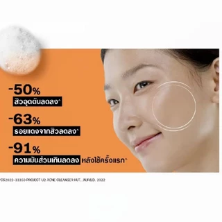 Neutrogena Oil-free Acne Wash นูโทรจีน่า เจลล้างหน้าลดสิว คุมมัน150มล/175มล.