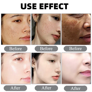 ครีมทาฝ้า 30ml ขจัดฝ้ากระ จุดดำ ผิวหน้าขาวใส
