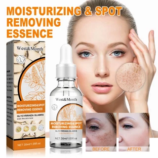 ครีมทาฝ้า 30ml ขจัดฝ้ากระ จุดดำ ผิวหน้าขาวใส