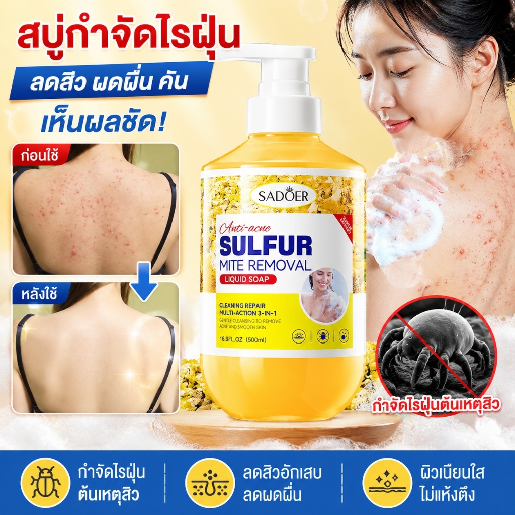 เจลอาบน้ำลดสิว กำจัดไร 500ml ต่อต้านเชื้อราแก้คัน ให้ผิวชุ่มชื้น อ่อนโยน กลิ่นหอมติดทน