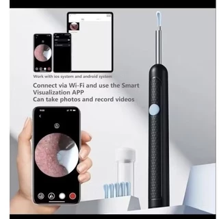 ไม้แคะหูไร้สาย กล้อง HD 360° สำหรับทำความสะอาดหู