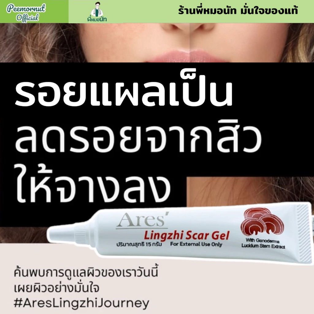 *แท้ Ares’ Lingzhi Scar Gel ลดรอยแผลเป็น แผลเป็นคีย์ลอยด์ แผลผ่าตัด แผลเป็นจากรอยสิว แผลผ่าตัดศัลยกร