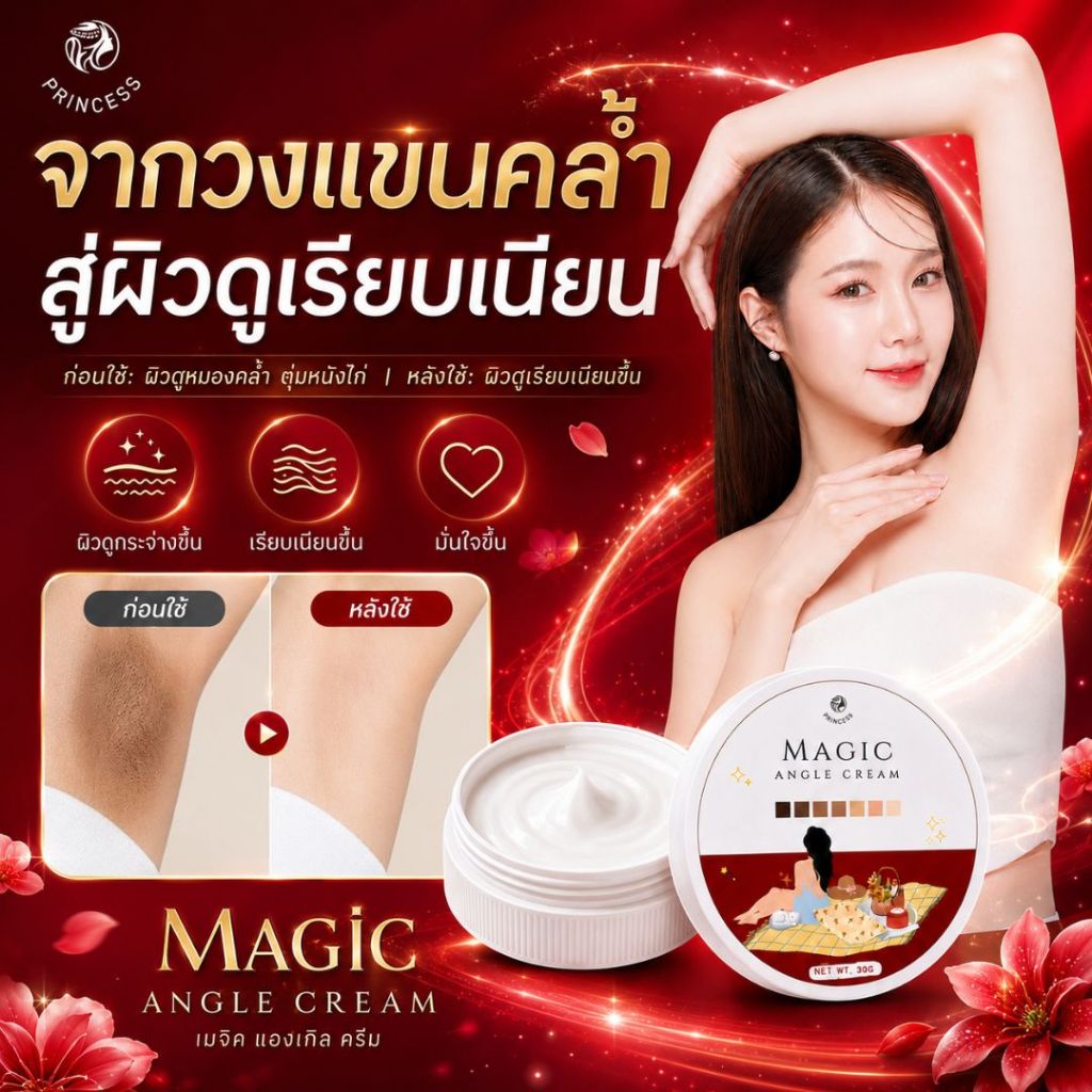 ✨【 Magic Angle ครีมรักแร้ขาว】ครีมทารักแร้ขาว  รักแร้ดำ รักแร้ด้าน ตูดลาย ลดกลิ่นกาย ลดกลิ่นตัว 30 g.