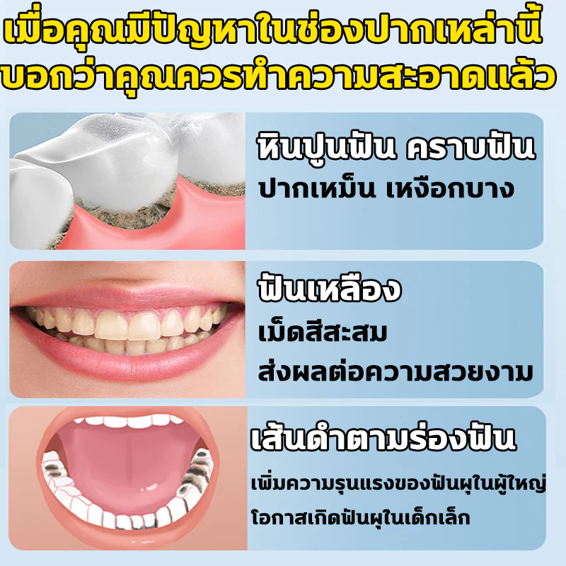 น้ำยาทำความสะอาดฟันไฟฟ้า 31000ครั้ง/นาที เครื่องขูดหินปูน การสั่นสะเทือนความถี่สูง ทำความสะอาดล้ำลึก IPX7 5 โหมดการทำควา thumbnail 9