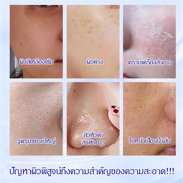 โฟมล้างหน้าใสขจัดสิวหัวดำ ทำความสะอาดลึกรูขุมขน รูปที่ 5
