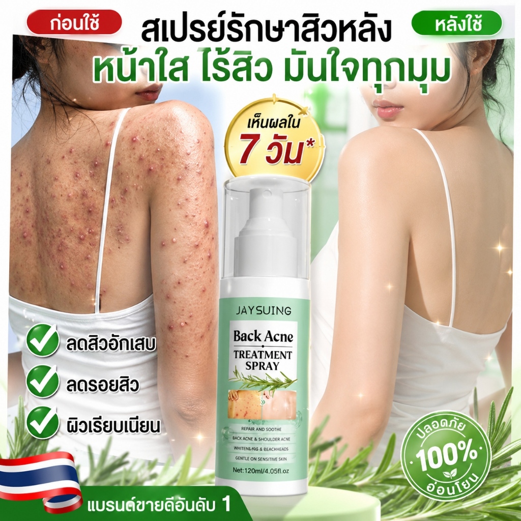 สเปรย์ฉีดลำตัวขนาด120มิล ขจัดสิวหลังแอคเน่ ลดไรบนร่างกาย ครีมแต้มสิว