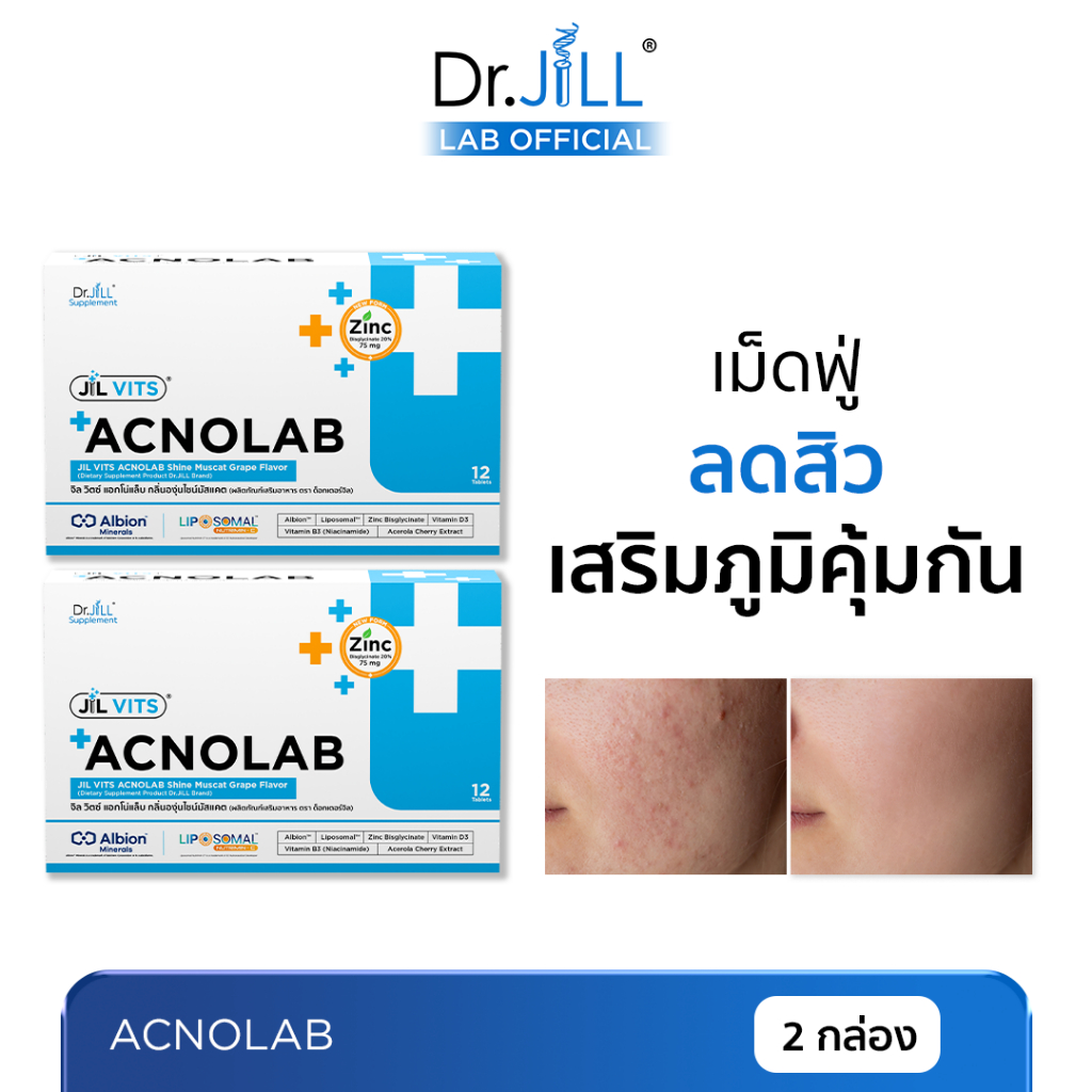 [ร้านบริษัท] 1 แถม 1 ACNOLAB ผลิตภัณฑ์เสริมอาหารเม็ดฟู่ แอกโน่แล็บ วิตามินดูแลผิวเป็นสิวง่าย 2 กล่อง