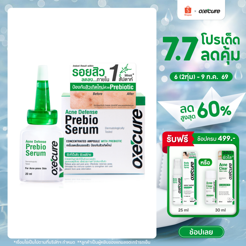 [สินค้าขายดี] Oxe'cure เซรั่มลดรอยสิว Acne Defense Prebio Serum 20 ml ลดการอักเสบ เพิ่มความชุ่มชื้น 10OX00105
