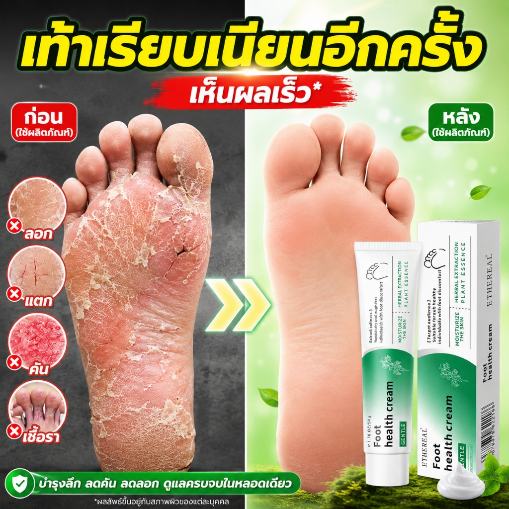 🦶ได้ผล100%🦶 ครีมระงับกลิ่นเท้า ครีมทาเท้า ลดกลิ่นเท้า เท้าแตก ลดเหงื่อ รองเท้าเหม็น ดับกลิ่นเท้า ครีมดูแลเท้า COD