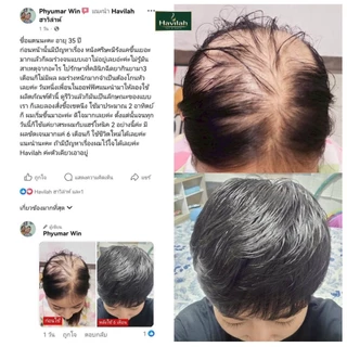 ฮาวิล่าห์ เจแปน โทนิคเสริมสร้างเส้นผมใหม่ ให้ผมดูหนามีวอลลุ่มขึ้น ขนาด 100 มล.