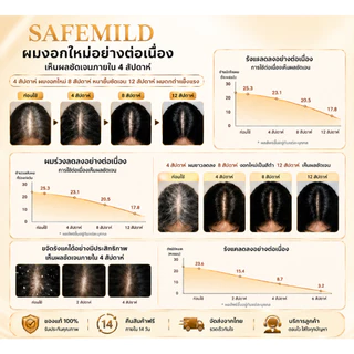 【ของแท้ 100% 】แชมพูสมุนไพร SAFEMILD ขนาด 300 มล. สูตรพืช ลดผมร่วง ผมหงอก และส่งเสริมการเจริญเติบโตของเส้นผม