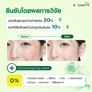 SMOOTO Official สมูทโตะ แอคเน่ แบริเออร์ ซูทติ้ง เซรั่ม (SMT200 / กล่อง)