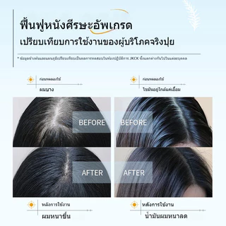 [ของแท้ พร้อมส่ง] JKCK แชมพู ควบคุมความมันบนหนังศีรษะ ขจัดรังแคได้ดี เพิ่มวอลลุ่ม ให้ผมปังดูมีปริมาตร