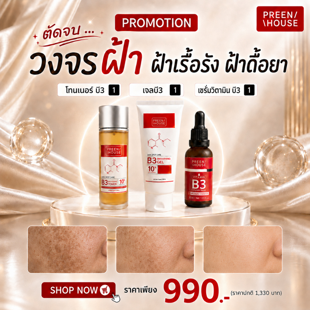 พรีนเฮ้าส์ หยุดวงจรฝ้าเรื้อรัง ฝ้าดื้อยา