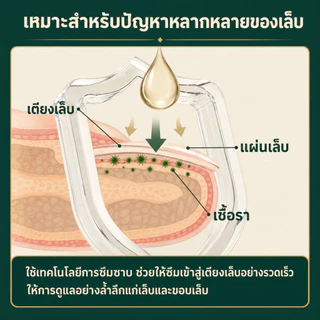 Kreain Natureน้ำยาบำรุงเล็บ บรรเทาผลกระทบจากเล็บติดเชื้อเล็บโค้งงอและเน่าเสีย และกำจัดเชื้อราได้