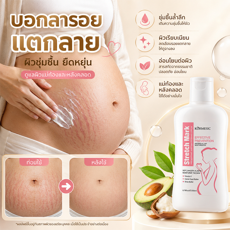 ครีมลดรอยแตกลาย ลดรอยแตกลาย เพิ่มความชุ่มชื้นให้แก่ผิว กระชับผิวให้เรียบเนียน ครีมทาแตกลาย ครีมทารอยแตกขา ครีมกันแตก