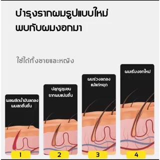 🔥ซื้อ 1 แถม 1🔥เซรั่มลดผมร่วง รากผมแข็งแรง บำรุงเส้นผม ลดขาดหลุดร่วง เหมาะทั้งผู้ชายและผู้หญิง