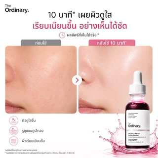 มาส์กหน้า The Ordinary AHA 30% +BHA 2% มีส่วนมขงกาลิไซลิก ช่วยคคควมมัน ลดรอผลเปากสิว และกจัดววดำ30ml