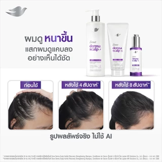 โดฟ แชมพูลดผมร่วง Derma Scalp 350 มล. X1