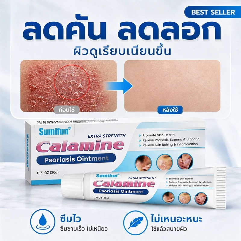 หยุดคันเร็ว ครีมแก้เชื้อรา ช่วยยับยั้งเชื้อรา บรรเทาอาการคันและผิวลอก เนื้อครีมบางเบา