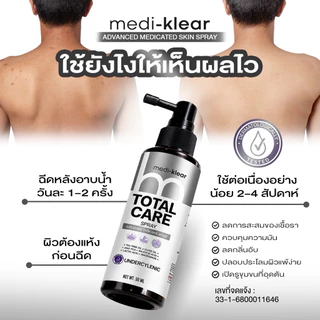 (เมดิเคลียร์) Medi-Klear สเปรย์สิวหลัง ขนคุด ผื่นคัน ผิวเชื้อรา Total Care Spray