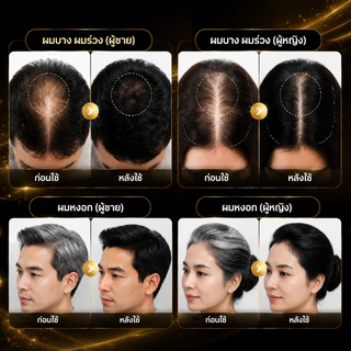 【ของแท้ 100% 】แชมพูสมุนไพร SAFEMILD ขนาด 300 มล. สูตรพืช ลดผมร่วง ผมหงอก และส่งเสริมการเจริญเติบโตของเส้นผม