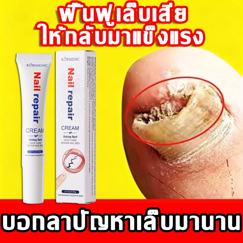【ทาเดียว กู้เล็บ】ยาทาเชื้อราที่เล็บ ช่วยดูแลเล็บให้ดูดี ใช้งานง่าย เหมาะสำหรับใช้เป็นประจำ