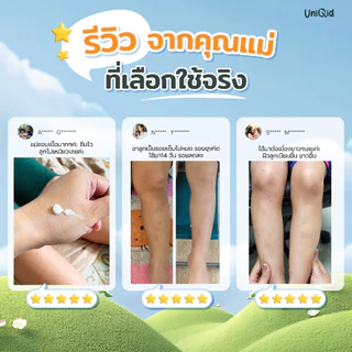 โลชั่นบำรุง ลดขาลาย ออร์แกนิค ยูนิคิด สำหรับเด็ก อ่อนโยน ปลอดภัย 100%
