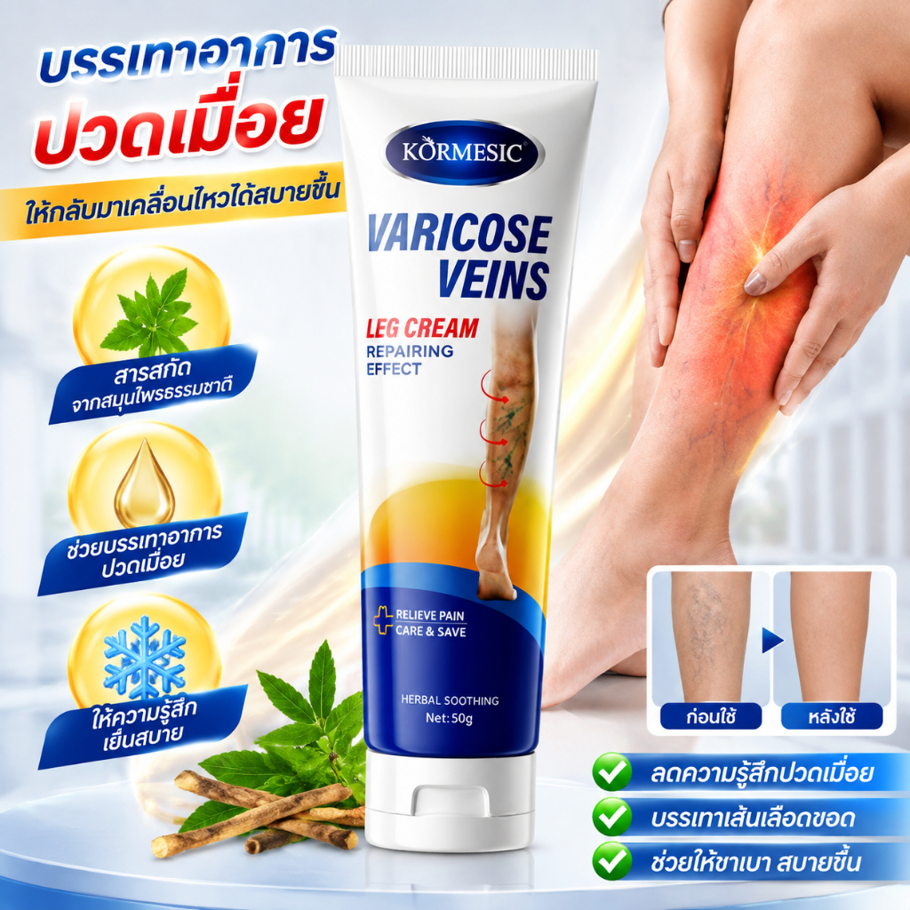 ครีมดูแลเส้นเลือดขอด KORMESIC Varicose Veins Leg Cream ครีมบำรุงขา ลดความรู้สึกเมื่อยล้า ดูแลผิวบริเวณขา เนื้อครีมซึมง่า