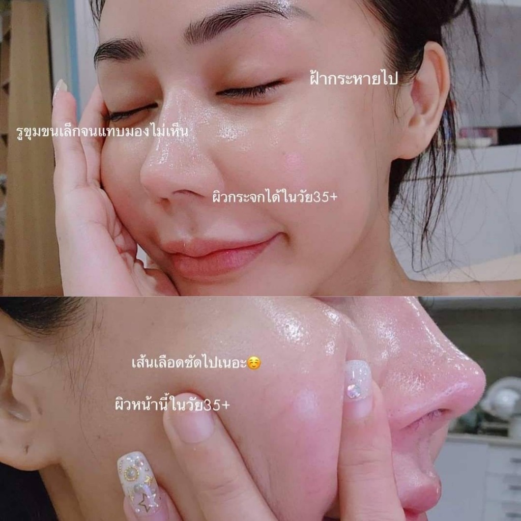 เซรั่มสดแก้ฝ้า Tranexamic Acid 3% + B3 5% ผิวกระจ่างใส ลดฝ้า กระ จุดด่างดำ เซรั่มลดฝ้ากระจุดด่างดํา Tranexamic acid — صورة 3