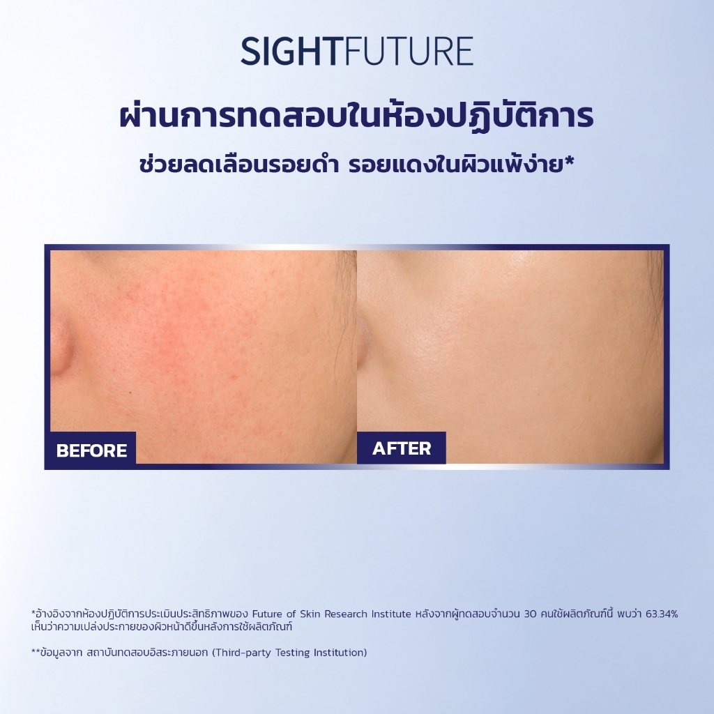 SIGHTFUTURE - SymWhite 377 Whitening Essence Mask Combination (1.5 + 25 ml.) 7 แผ่น มาส์ก 2 ขั้นตอน บูสต์ผิวกระจ่างใส — صورة 2